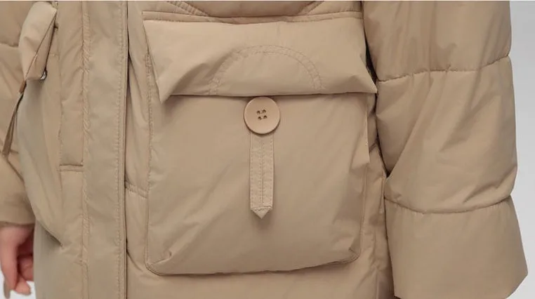Oversized Windproof Knee-length Puffer Coat for Everyday Style